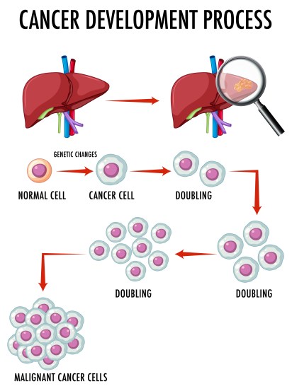Cancer development process illustration