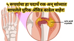 फक्त ५ रूपयांचा हा पदार्थ रक्त अन् सांध्यात साचलेले सर्व युरिक अ‍ॅसिड झटक्यात काढेल बाहेर! संधिवाताच्या त्रासातून होईल सुटका