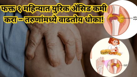 Reduce uric acid in just 1 month – Risk is increasing among young people!