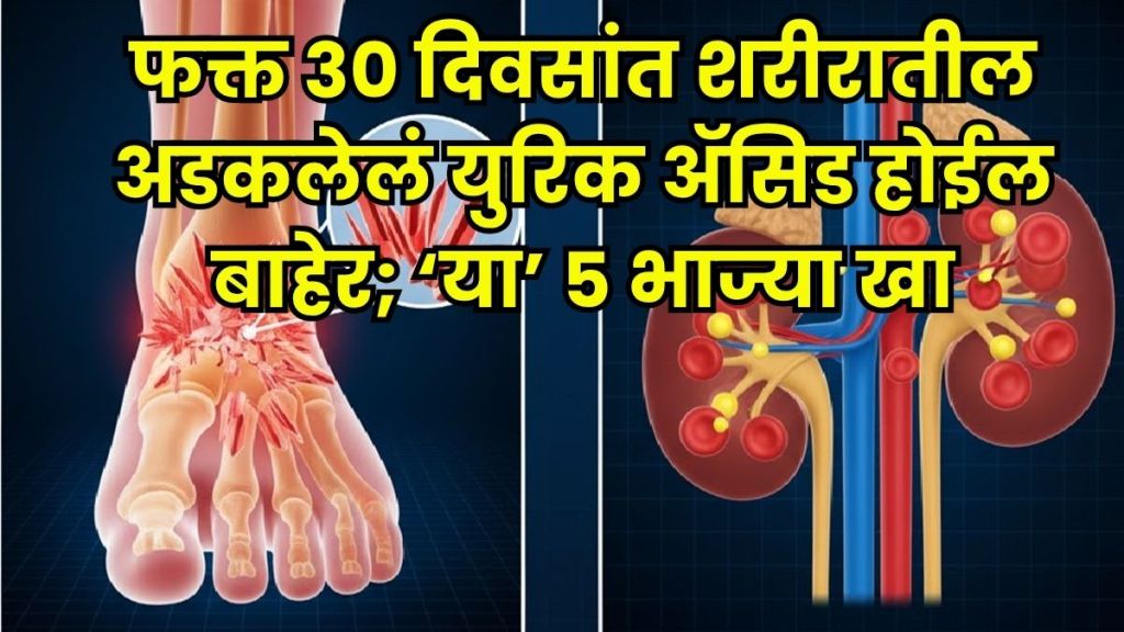 Uric Acid Reduction Uric Acid Reduction