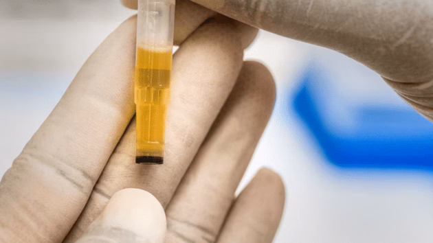 Signs you’re drinking enough water