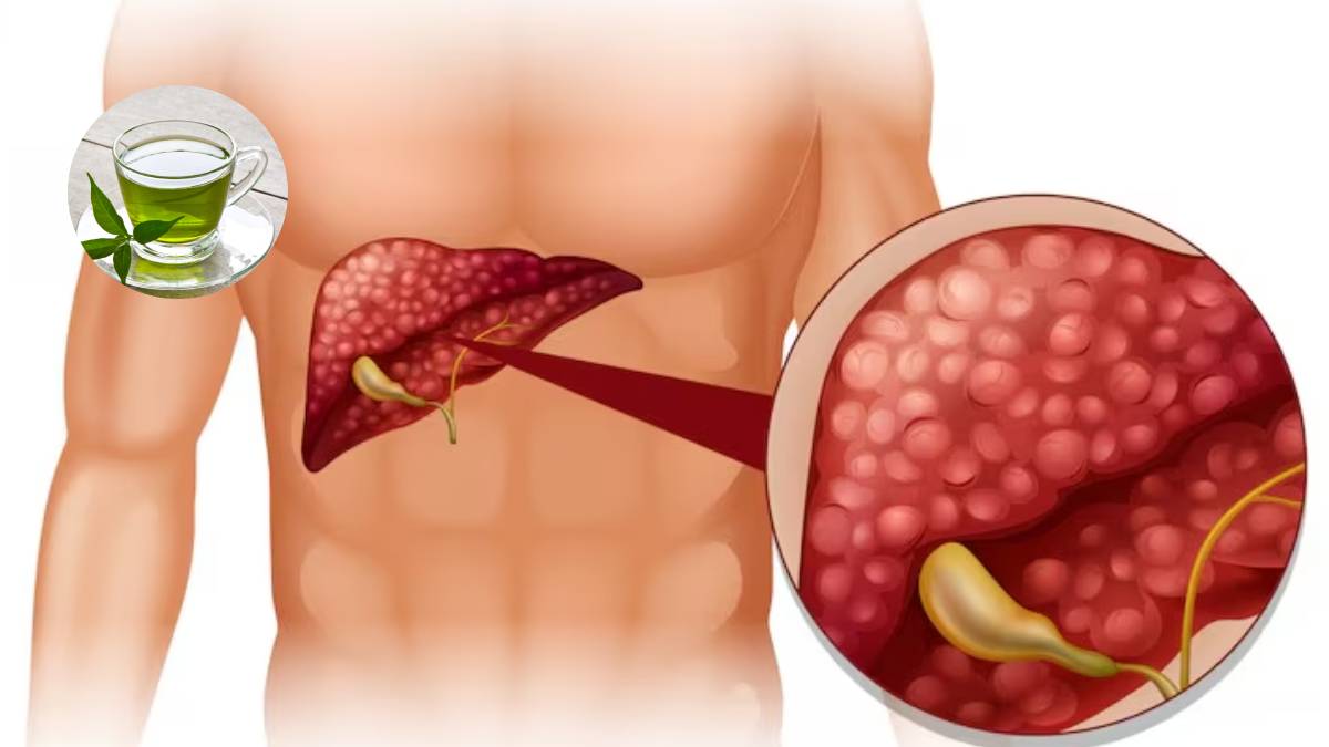 Natural drinks and healthy habits for fatty liver