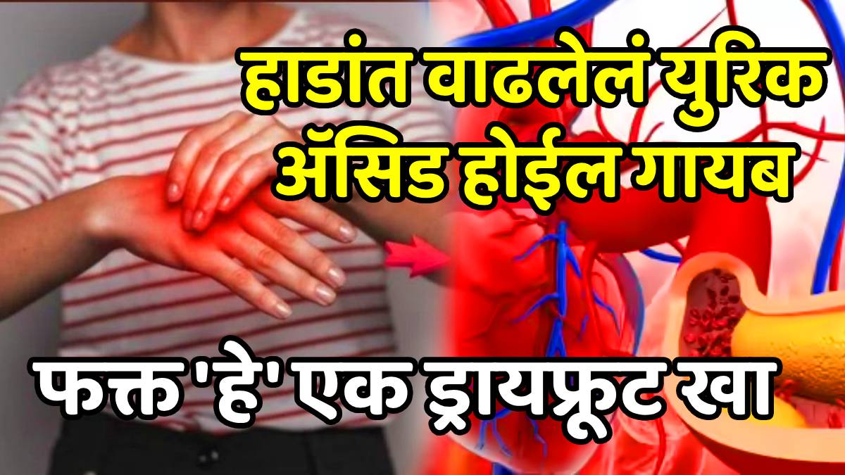 Uric acid foods diet health walnut benefits for uric acid control dosage and tips