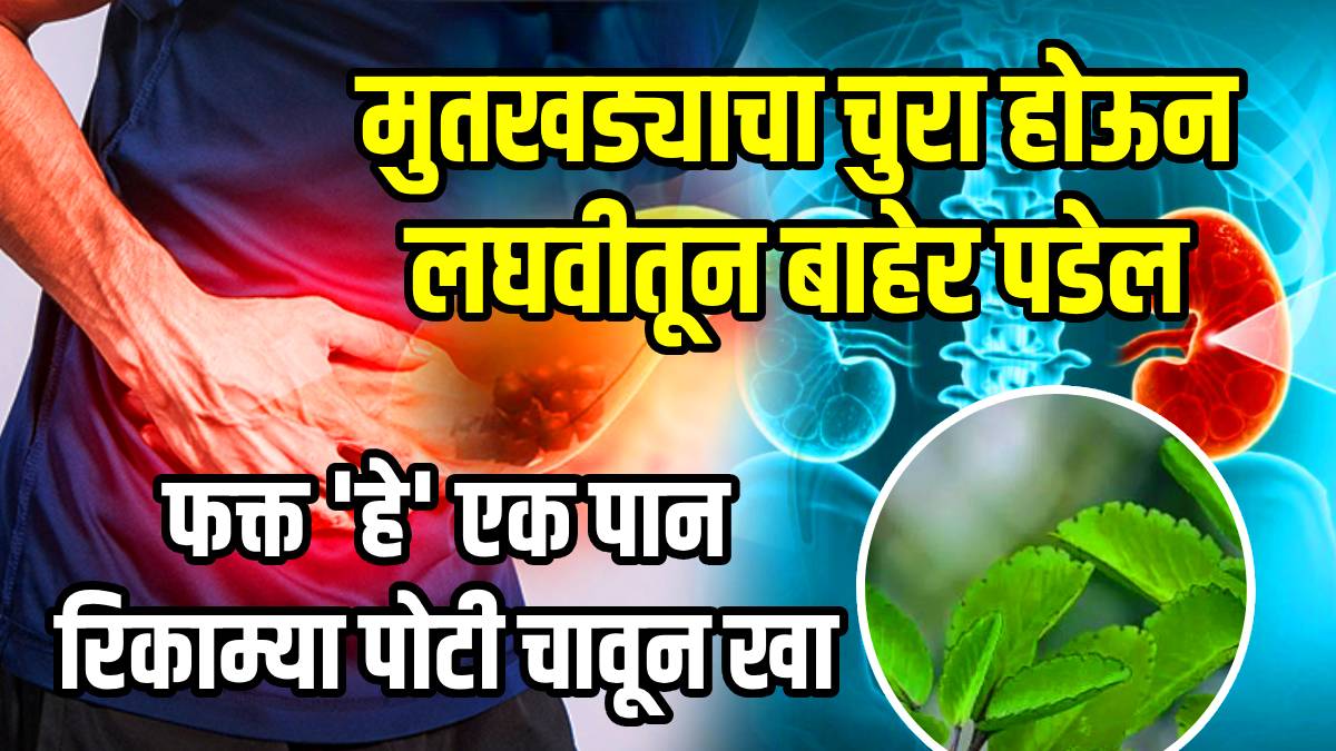 Patharchatta Remove kidney stone