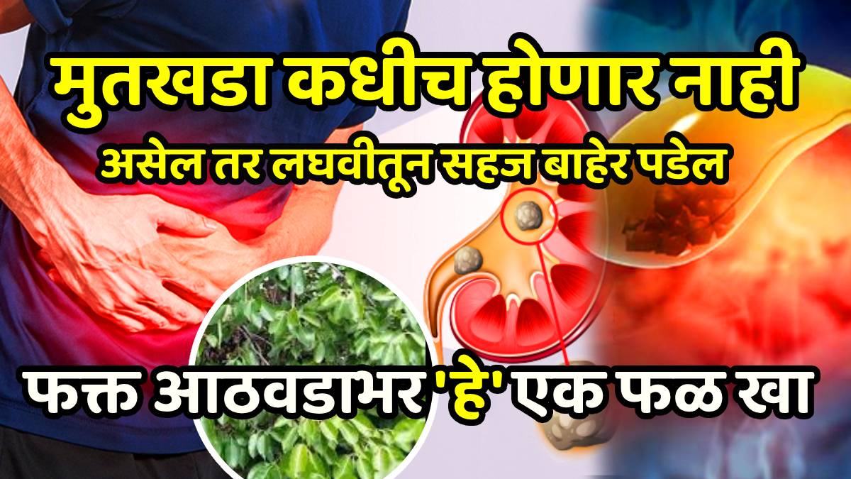 kidney stones How to clear kidney stones? Eat this fruit daily to prevent kidney stones