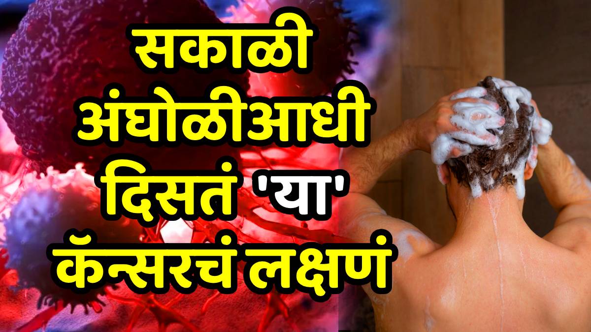 This cancer symptom appears before going to the bathroom Colon cancer in youngsters