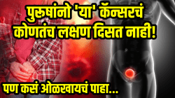 पुरूषांनो ‘या’ कॅन्सरचं कोणतंच लक्षण दिसत नाही! पण तो नेमका कसा ओळखायचा, जाणून घ्या; वेळीच वाचेल जीव…