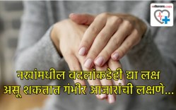 नखांमधील ‘हे’ पाच बदल… आणि तुमचे शरीर ओरडून सांगते भविष्यातील ‘हे’ धोके, वेळीच सावध व्हा