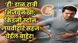 मोठ्यातला मोठा किडनी स्टोन तोडते &#8216;ही&#8217; डाळ, लघवीद्वारे सहज येईल बाहेर! रोज खाल्ल्यास सांधेदुखी, संधिवात आणि सूजही कमी होण्यास मदत