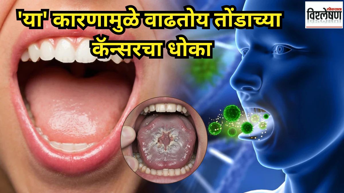 alcohol and mouth cancer