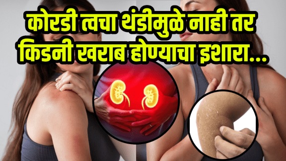 Kidney damage signs on skin dry itchy skin in winters indicates kidney problems