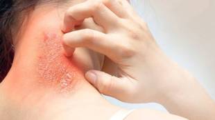 skin issues due to hormones