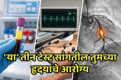 हार्ट अटॅकला वेळीच रोखा, फक्त योग्य वेळी करा ‘या’ तीन टेस्ट… तज्ज्ञ सांगतात या टेस्ट करणं का आहे गरजेचं?