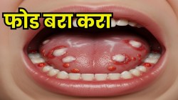 तोंडात लाल-पांढरे फोड येतायत? फक्त ‘या’ फळांची पानं खा; फोड बरे होतीलच, पोटही होईल मोकळं, आचार्य बालकृष्णांनी सांगितला उपाय!