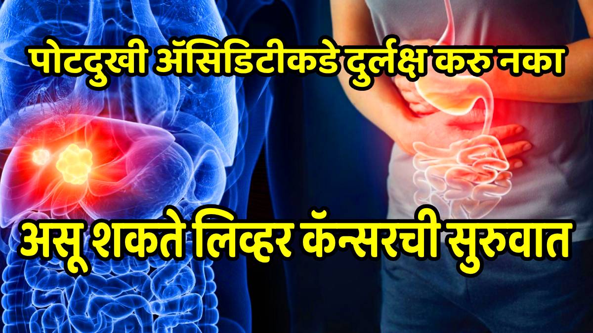 Symptoms of fatty liver