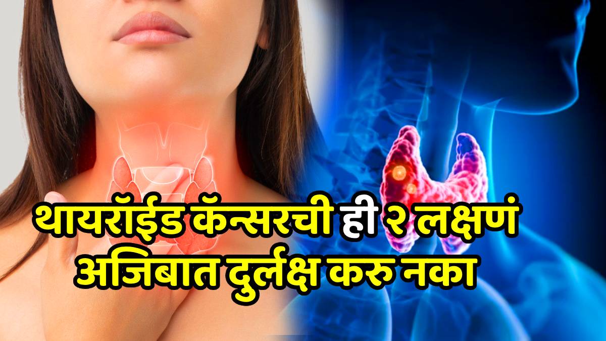 Thyroid cancer often hides in plain sight doctor urges women those with neck symptoms and others to get checked routinely