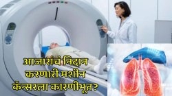 CT Scan Warning: सीटी स्कॅनमुळे होऊ शकतो कॅन्सर? संशोधनातून समोर आली धक्कादायक माहिती समोर