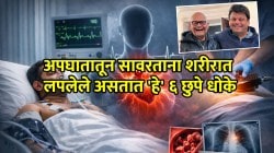 Agnivesh Agarwal Death: हार्ट अटॅक की कार्डिअ‍ॅक अरेस्ट? अपघातानंतर रुग्ण ‘रिकव्हरी’ मोडमध्ये असताना हृदय का थांबते?