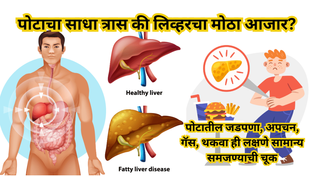 Silent Symptoms of Fatty Liver Silent Symptoms of Fatty Liver