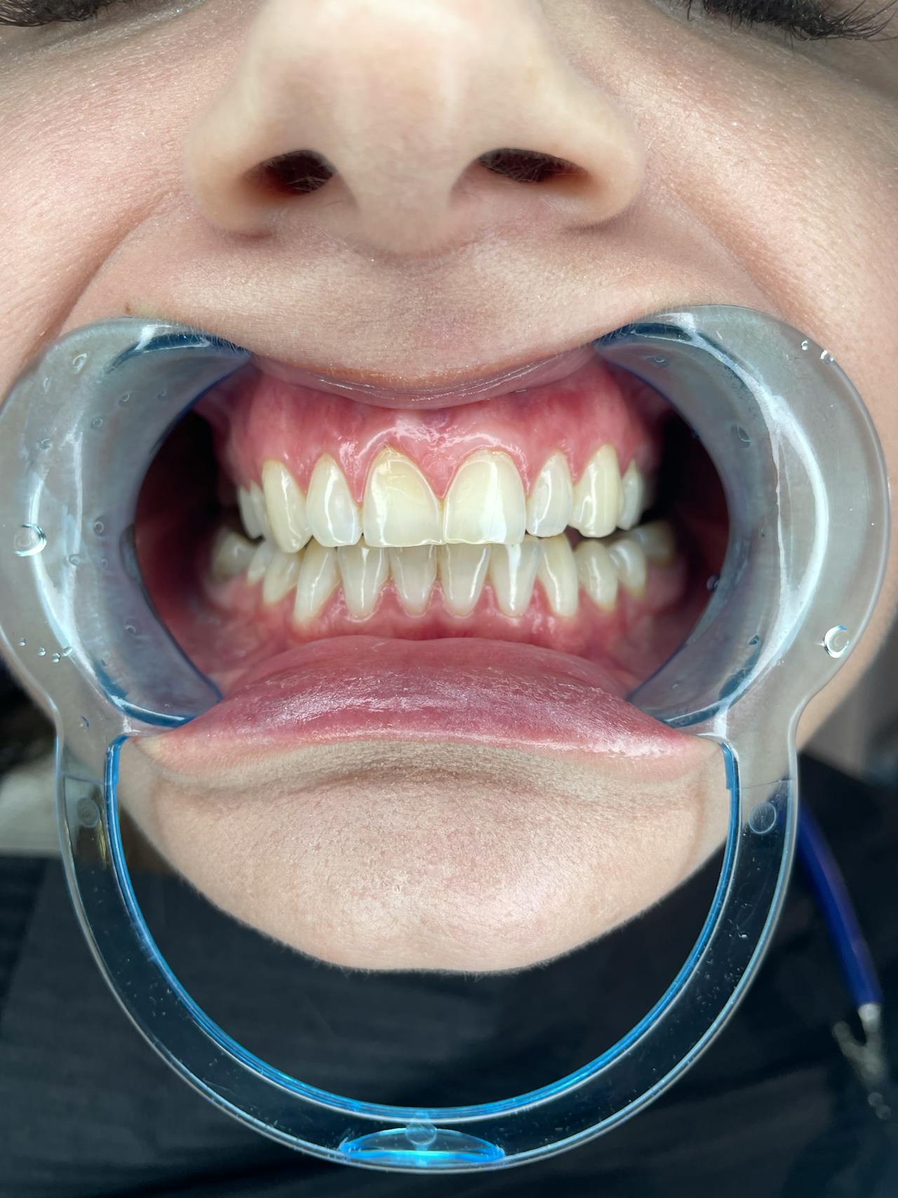 how to take care of teeth
