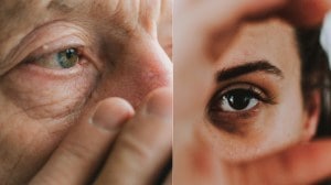 डोळ्यांखालच्या सुरकुत्या करा अशा कमी, चेहराही दिसेल तेजस्वी; जाणून घ्या उपाय