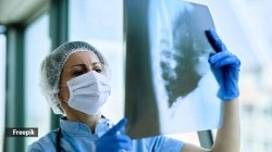 फुफ्फुसाच्या कर्करोगाच्या रुग्णसंख्येत २०३० पर्यंत वाढ! महिलांमध्ये वाढीचा वेग सर्वाधिक…