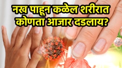 नख पाहून कळेल शरीरात कोणता आजार दडलाय? साध्या वाटणाऱ्या लक्षणांकडे दुर्लक्ष करू नका, ताबडतोब करा ‘ही’ गोष्ट…