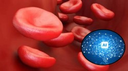 ‘सिकल सेल’साठी ‘एआय’वर आधारित एकात्मिक प्रणाली; काय आहे महत्त्व?