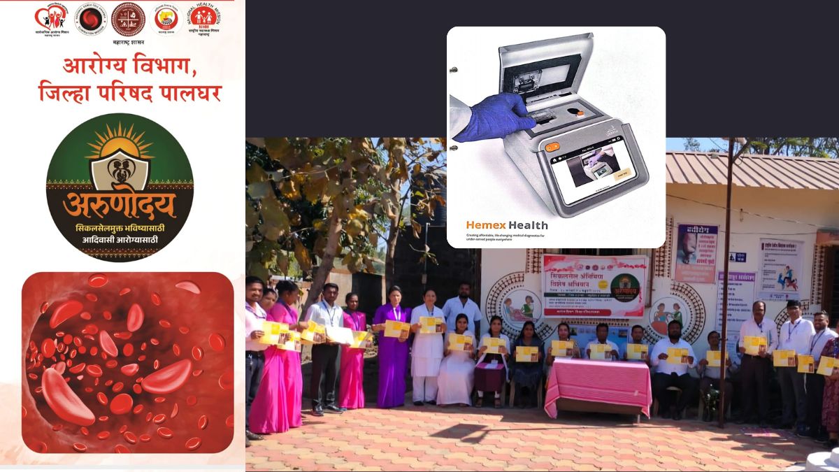palghar-arunoday-sickle-cell-anemia-special-campaign