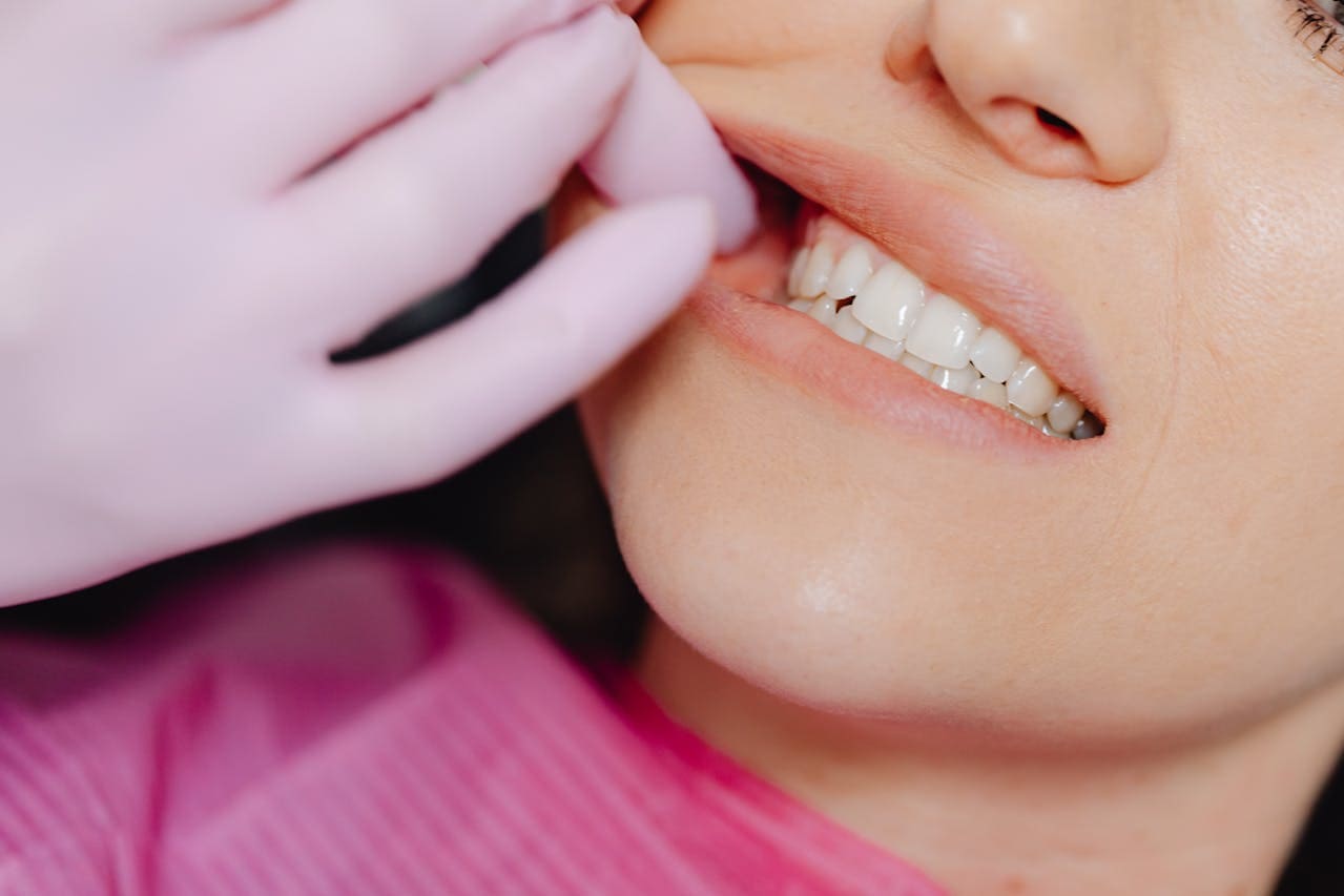 how to take care of teeth