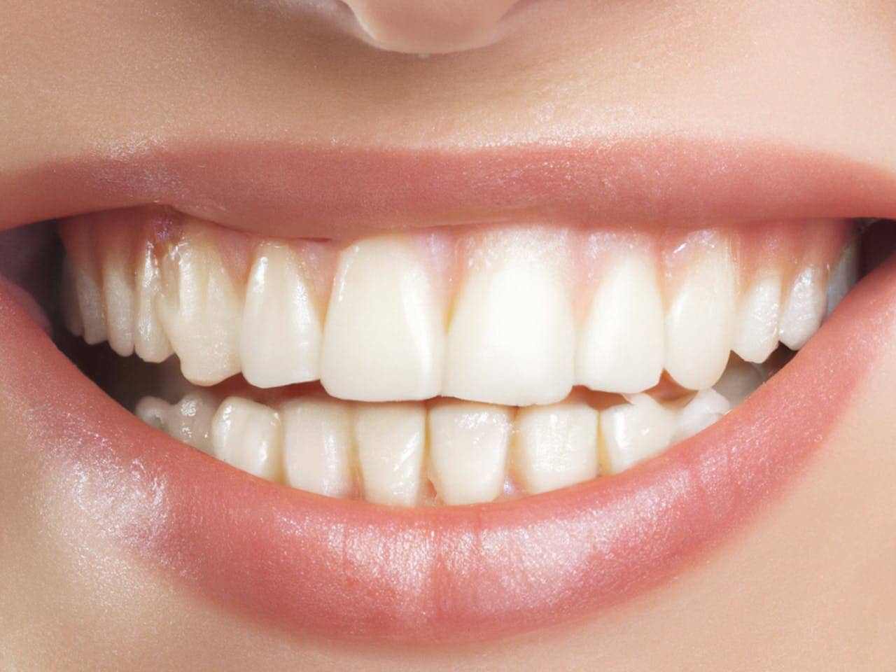 how to take care of teeth