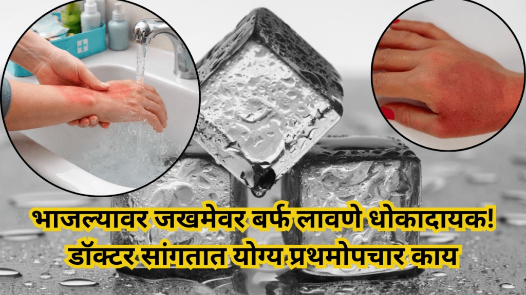 why-common-burn-remedies-are-dangerous why-common-burn-remedies-are-dangerous