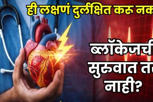 Coronary Artery Disease Signs