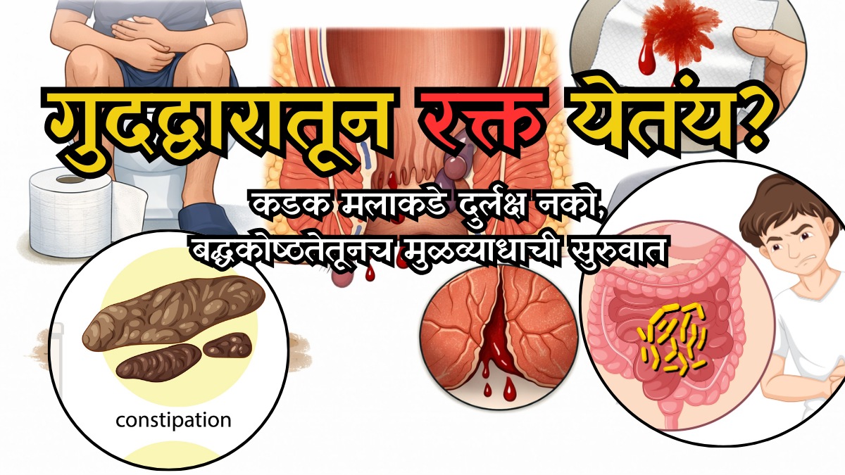 Constipation and Piles