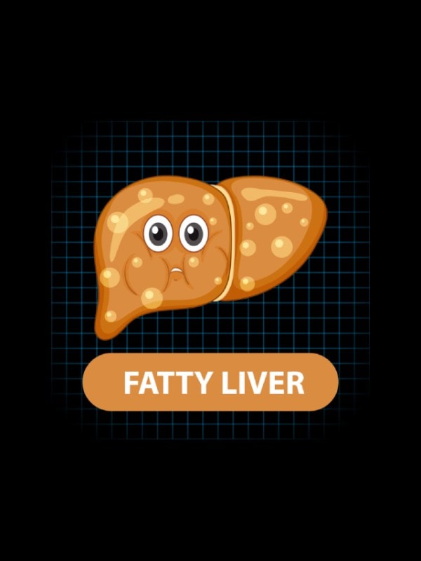 Fatty Liver Home Remedies