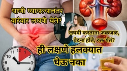पाणी प्यायल्यानंतर वारंवार लघवी येते? लघवी करताना जळजळ, वेदना होते, रक्त दिसतं? ही लक्षणे हलक्यात घेऊ नका