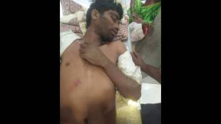 A young accident victim faced extreme negligence at Gadchiroli Civil Hospital despite recent ministerial visits.
