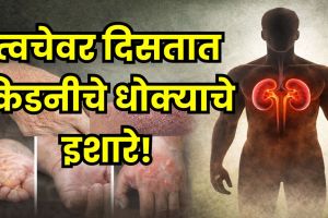 Kidney Health Warning Signs