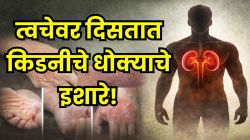 तुमच्या त्वचेवर दिसतायत ‘हे’ ६ बदल? सावध राहा! किडनी खराब होण्याचा असू शकतो पहिला इशारा