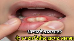 जीभ-ओठांवर वारंवार फोड? ‘या’ व्हिटॅमिन्सची कमतरता ठरते कारण; ५ पदार्थांनी मिळवा झटपट आराम