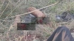 Brutal Murder: क्रूरतेचा कळस! चांदीच्या पैंजणासाठी चोरट्यांनी ६० वर्षीय महिलेचे दोन्ही पाय तोडले, गळा चिरुन केली हत्या