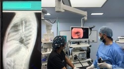 सांगलीतील शासकीय रुग्णालयात गुंतागुंतीची शस्त्रक्रिया; मुलीला जीवदान…