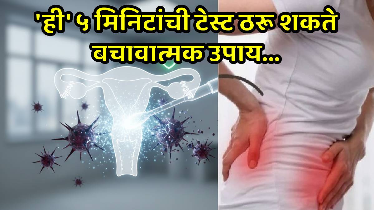 Cervical cancer screening