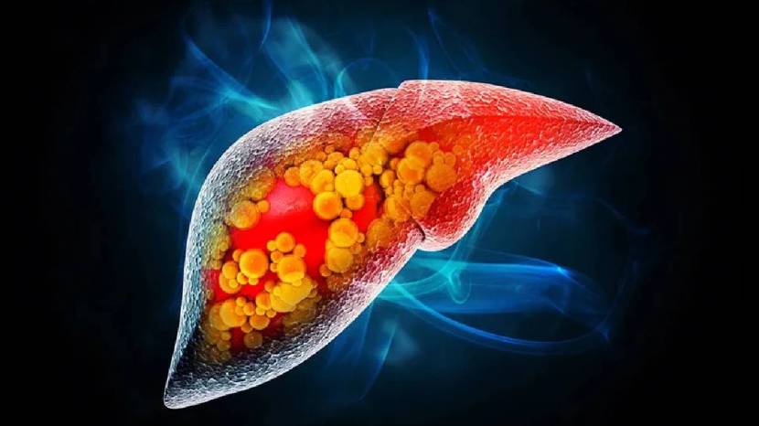 fatty liver diet if you want to get rid of fatty liver then include buttermilk banana and cabbage in your diet