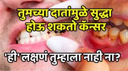 सावधान! तुमच्या दातांमुळे सुद्धा होऊ शकतो कॅन्सर? ‘ही’ लक्षणं तुम्हाला नाही ना? दर्लक्ष न करता लगेच जाणून घ्या