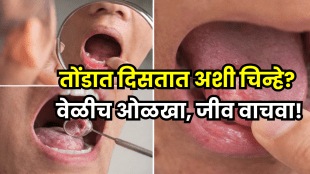 Oral Cancer Alert: Persistent Mouth Sores, Red or White Patches Could Signal Serious Risk