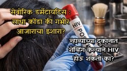 डोक्यावरचा साधा कोंडा की गंभीर आजाराचा इशारा? HIVशी खरचं संबध आहे का? सत्य तज्ज्ञांकडून जाणून घ्या