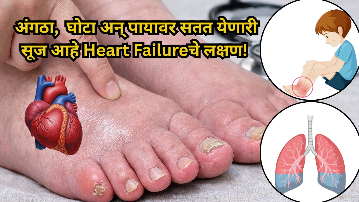 Heart Health Swelling in Feet or Toes May Indicate Heart Failure