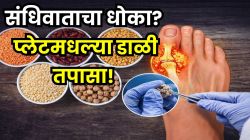 युरिक ॲसिड झपाट्याने वाढवतात ‘या’ ५ डाळी; संधिवात, गुडघेदुखी आणि मुतखड्याचा धोका टाळण्यासाठी ही यादी एकदा पाहाच!