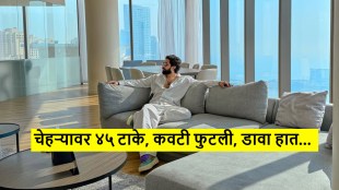 amaal mallik 45 stitches on face broken knee